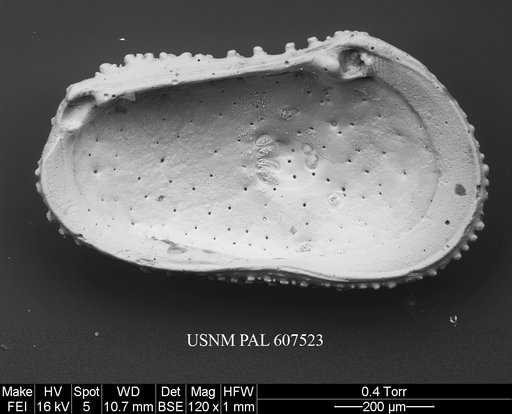 Echinocythereis margaritifera (Brady, 1870)