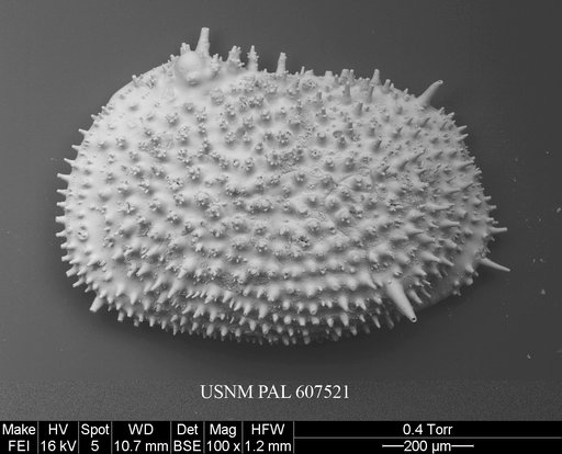 Echinocythereis margaritifera (Brady, 1870)