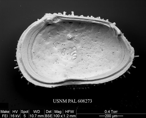 Echinocythereis margaritifera (Brady, 1870)
