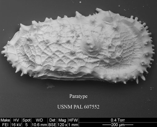 Cythereis sylvesterbradleyi Yasuhara et al., 2015