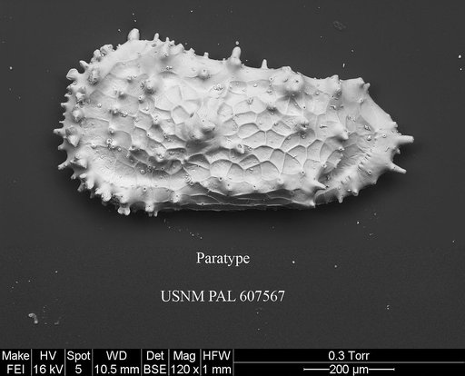 Cythereis bensoni Yasuhara et al., 2015
