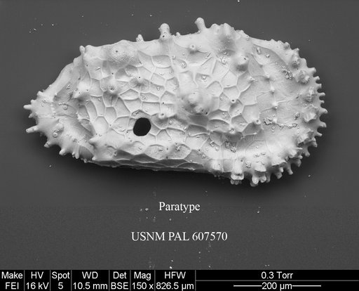 Cythereis bensoni Yasuhara et al., 2015