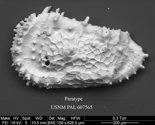 Cythereis bensoni Yasuhara et al., 2015
