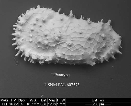 Cythereis bensoni Yasuhara et al., 2015
