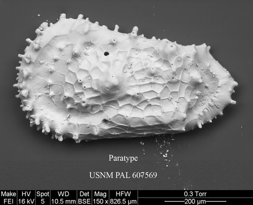 Cythereis bensoni Yasuhara et al., 2015