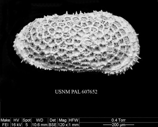 Bensonocosta sp. 1 Yasuhara et al., 2015