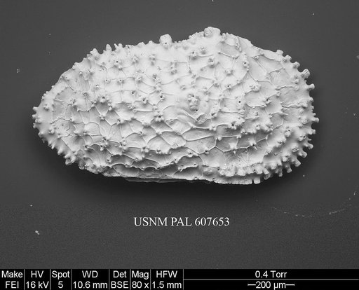Ayressoleberis cf. colesi Yasuhara et al., 2015