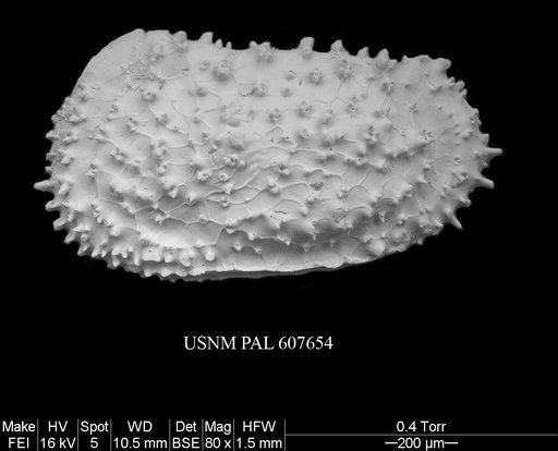 Ayressoleberis cf. colesi Yasuhara et al., 2015