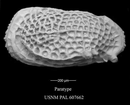Leguminocythereis ? buzasi Yasuhara et al., 2015