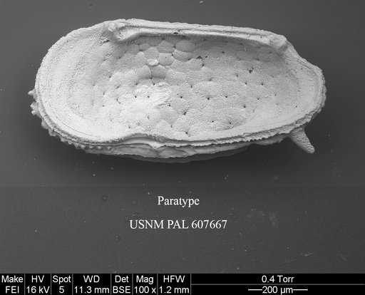 Leguminocythereis ? buzasi Yasuhara et al., 2015