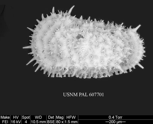 Legitimocythere acanthoderma s.l. (Brady, 1880)