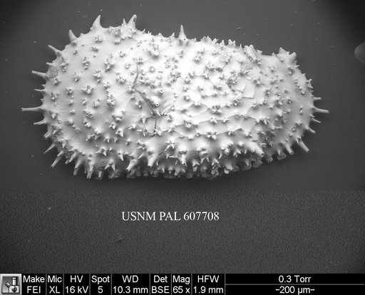 Legitimocythere acanthoderma s.l. (Brady, 1880)