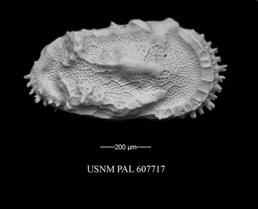 Herrigocythere cenozoica (Benson, 1977)
