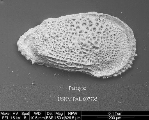 Ryugucivis acuminata Yasuhara et al., 2015