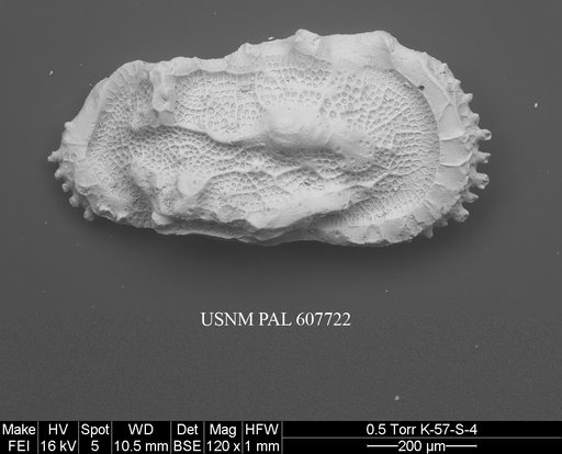 Herrigocythere cenozoica (Benson, 1977)