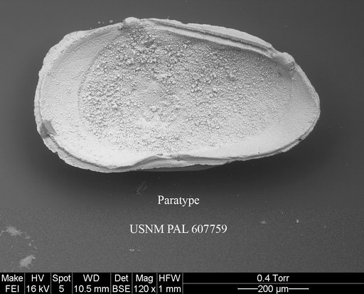 Phacorhabdotus nudus Yasuhara et al., 2015