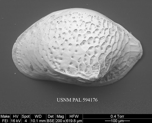 Cytheropteron pseudoinflatum Whatley & Eynon, 1996