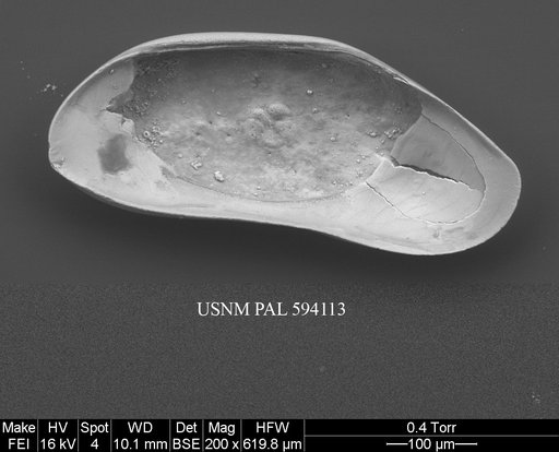 Argilloecia cf. robinwhatleyi Yasuhara et al., 2009
