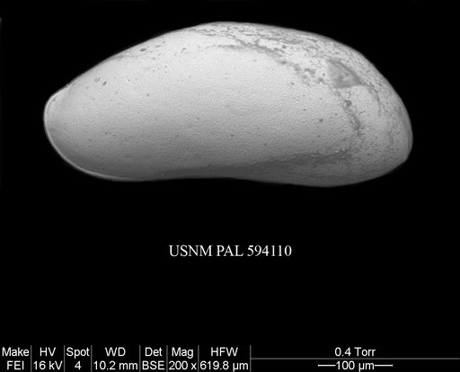 Argilloecia cf. robinwhatleyi Yasuhara et al., 2009