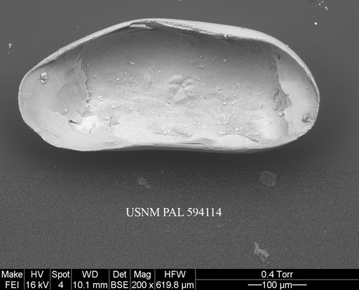Argilloecia cf. robinwhatleyi Yasuhara et al., 2009