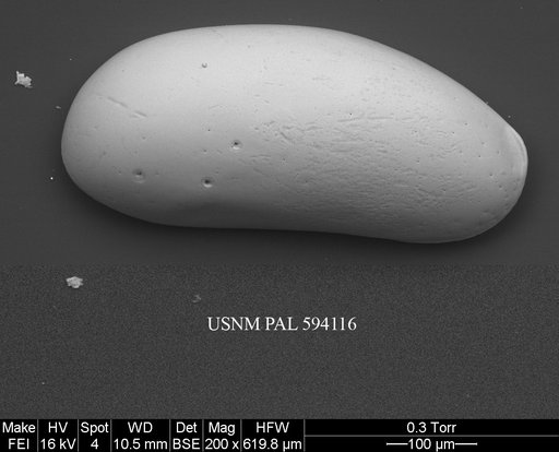 Argilloecia cf. robinwhatleyi Yasuhara et al., 2009