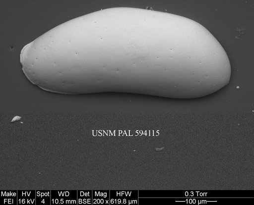 Argilloecia cf. robinwhatleyi Yasuhara et al., 2009