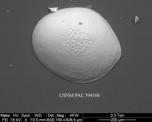 Polycope sp. 1 Yasuhara et al., 2014