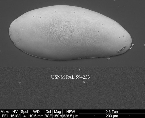 Paradoxostomatid sp. 1 Yasuhara et al., 2014