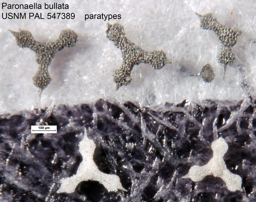 Paronaella bullata Yeh & Pessagno, 2013