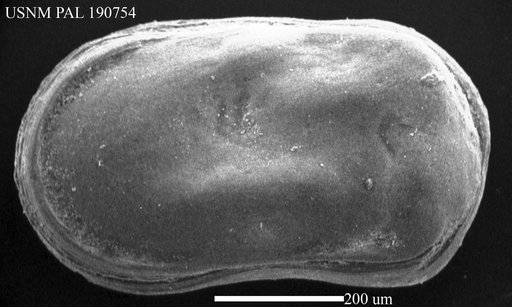 Cytherella sp.