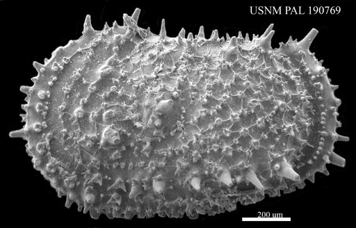 Thalassocythere acanthoderma ? (Brady, 1880)