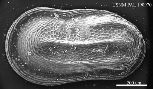 Cytherelloidea sp