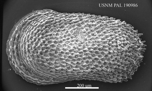 Cytherella sp.