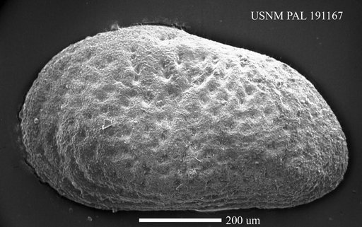 Eucytheridea sp.