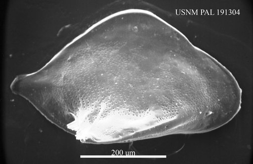 Cytheropteron sp.
