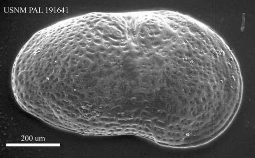 Cytherissa lacustris Sars, 1863