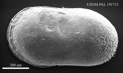 Cytherella vulgata Ruggieri, 1962