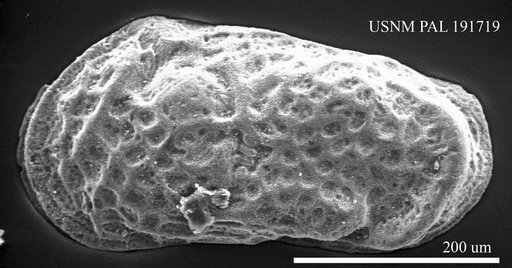 Leptocythere sp.
