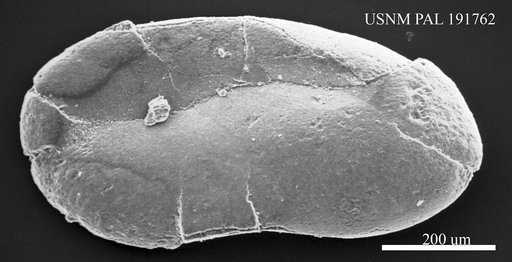 Cytherella ? sp.