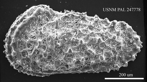 Acanthocythereis montgomeryensis ? Howe & Chambers, 1935