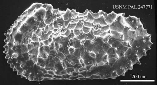 Acanthocythereis sp