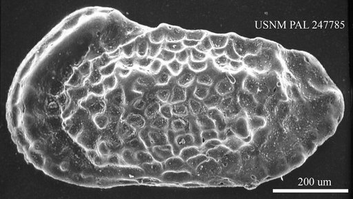 Acanthocythereis sp