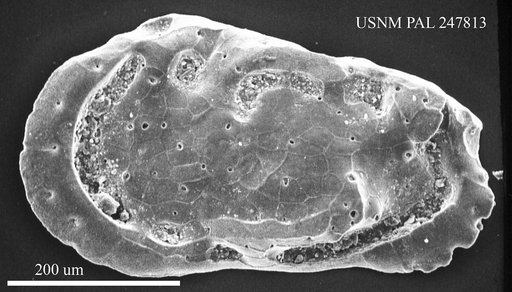 Occultocythereis sp