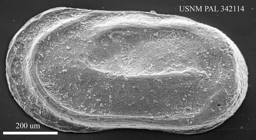 Cytherelloidea sp