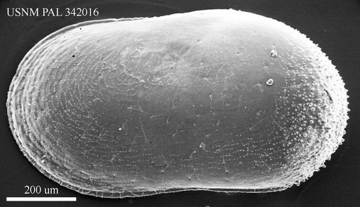Cytherella vulgata Ruggieri, 1962