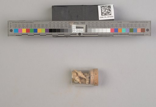 NSF ADBC EPICC TCN