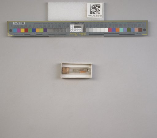 NSF ADBC EPICC TCN