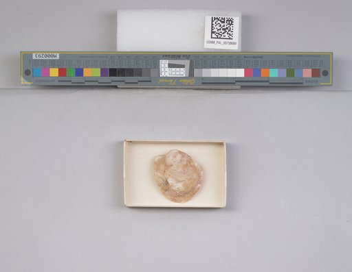 NSF ADBC EPICC TCN