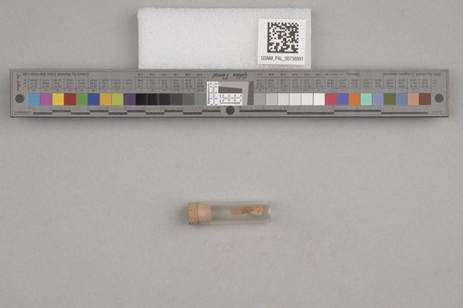 NSF ADBC EPICC TCN