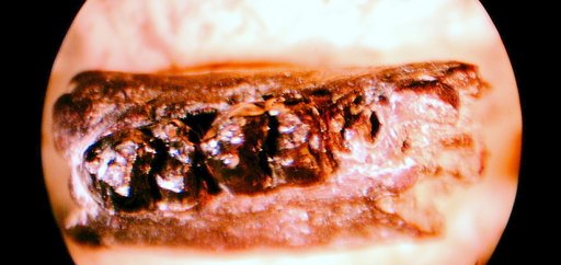 Anisonchus onostus Gazin